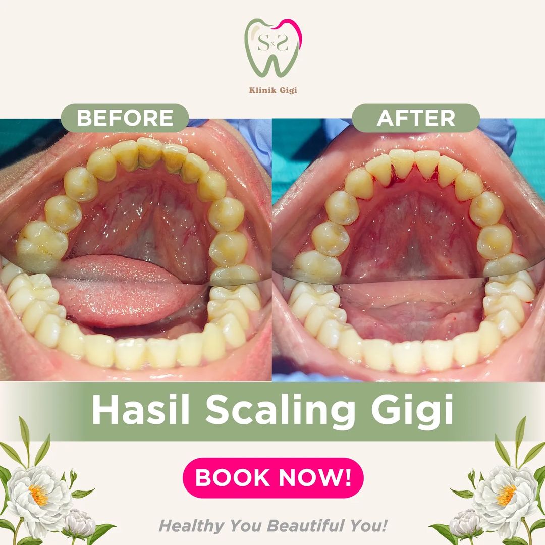 Scalling SNS Klinik 3