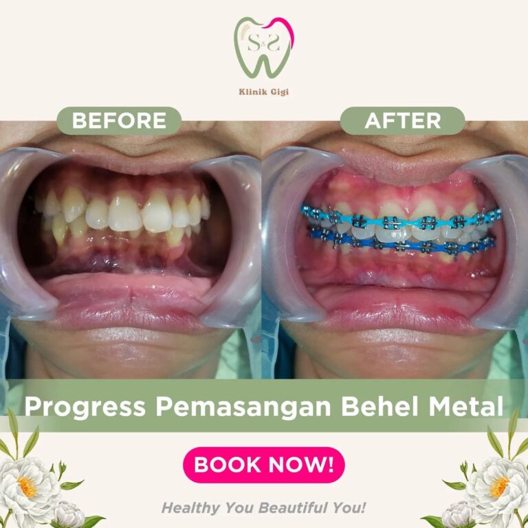 SNS Klinik Behel