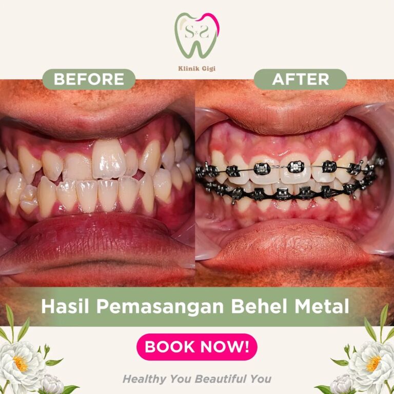 SNS Klinik Behel