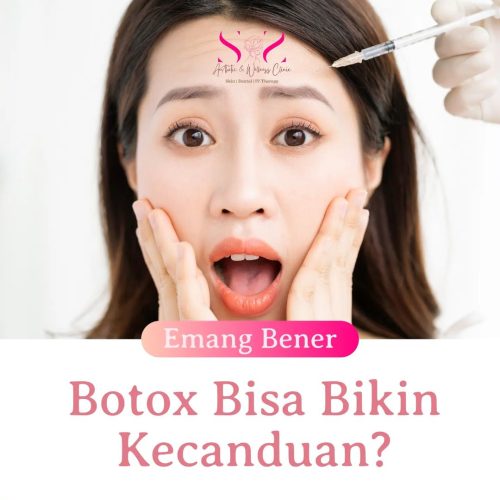 SNS Klinik Botox