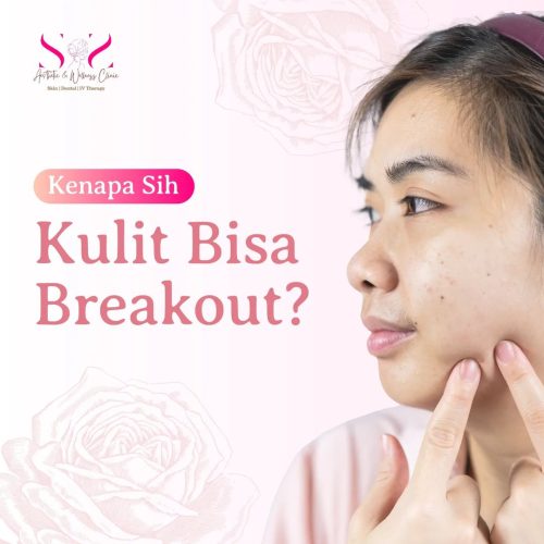 SNS Klinik Breakout