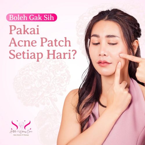 SNS Klinik Acne Patch