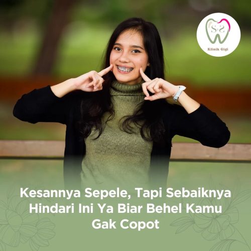 SNS Klinik Agar Behel Tidak Copot