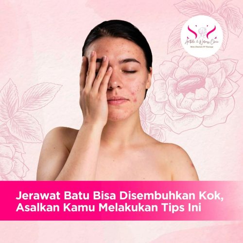 SNS Klinik Jerawat Batu